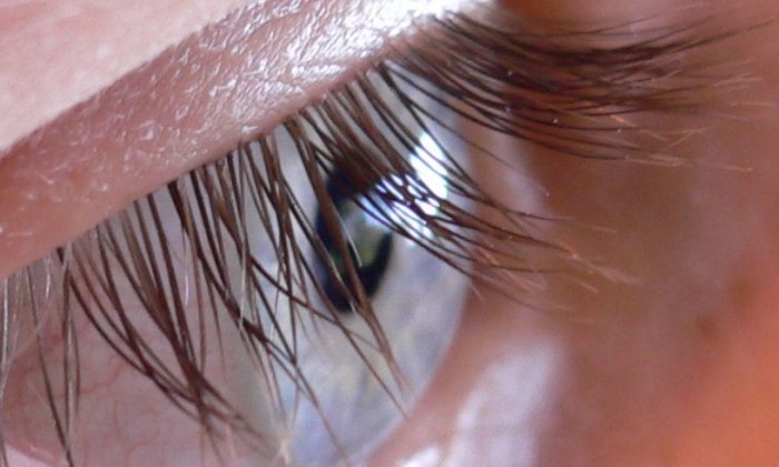 Woman Complained of ‘Itchy Eyes,’ Then Doctors Make Unusual Find in Her Eyelashes
