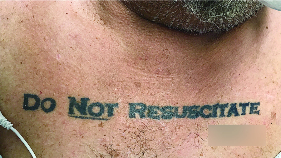 Doctors Face Ethical Nightmare When Discovering Patient’s ‘Do Not Resuscitate’ Tattoo