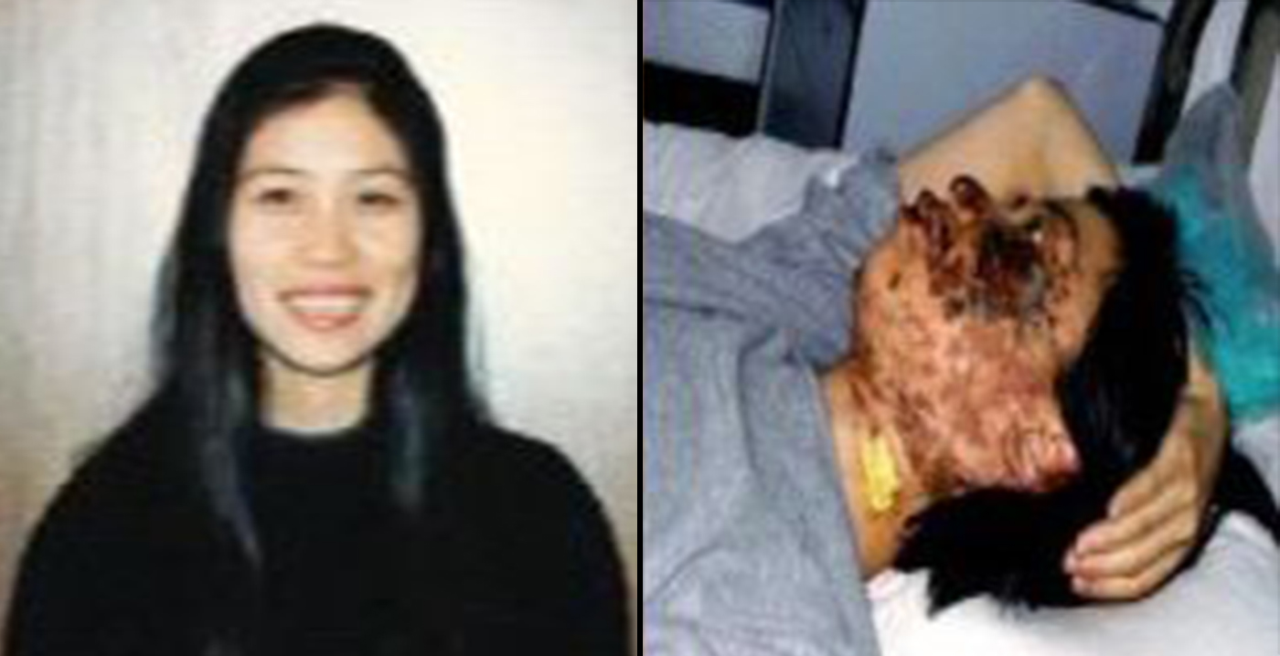 Gao Rongrong's photo before her death. The right photo was taken 10 days after her disfiguration. (Minghui.net)