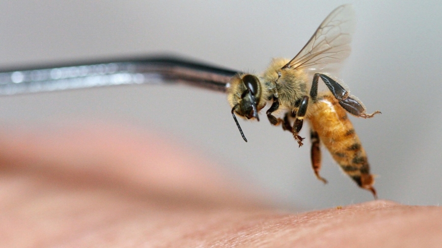 Woman Dies After Acupuncture Session Using Live Bees