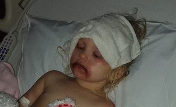 Mother Shares Shocking Pictures of 3-Year-Old Girl After Severe Allergic Reaction to Cheap Makeup