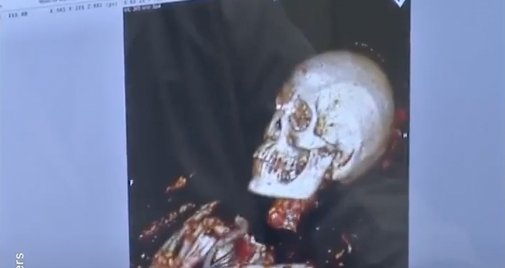 Scientists Scan This 4000-Year-Old Mummy—They are Shocked To Discover How He Died