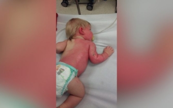 Baby Gets Burned With Garden Hose—Firefighters Reveal How It Happened