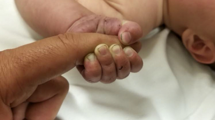 'Miracle': Baby Buried Alive in Montana Woods for 9 Hours Saved by Deputy