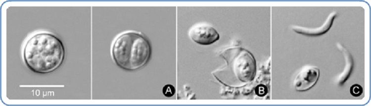 Infected people shed unsporulated (non-infective; immature) Cyclospora cayetanensis oocysts in their stool; immature oocysts usually require at least 1–2 weeks under favorable laboratory conditions to sporulate and become infective . An unsporulated oocyst, with undifferentiated cytoplasm, is shown (far left), next to a sporulating oocyst that contains two immature sporocysts (A). An oocyst that was mechanically ruptured has released one of its two sporocysts (B). One free sporocyst is shown as well as two free sporozoites, the infective stage of the parasite (C). (Credit: CDC/DPDx)