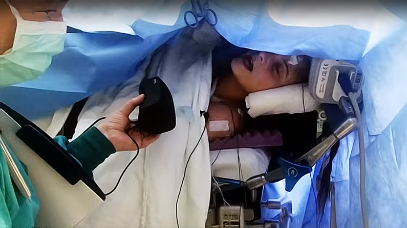 Kira sang Weezer’s “Islands in the Sun” while surgeons cut into her brain. (Screenshot/Seattle Children's Hospital via Storyful)