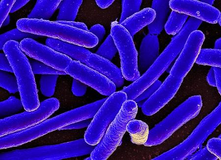 Escherichia coli, known as E. coli. (National Institute of Allergy and Infectious Diseases)