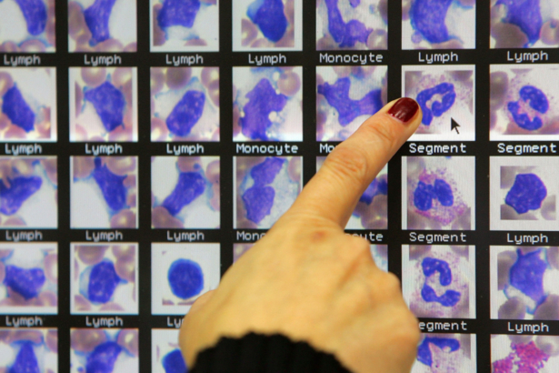 File photo showing a lab technician double-checking blood test results at a laboratory in Nes Tsiona, Israel, on Jan. 22, 2006. (David Silverman/Getty Images)