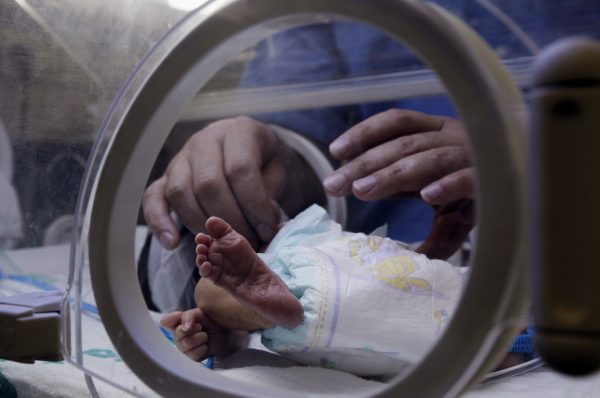 ‘Miracle Baby’ Born at 23 Weeks Weighing 13 Ounces