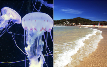 Man Describes Jellyfish Sting To be Like ‘Fire’