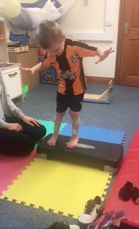 Four year old Ronnie is undergoing physiotherapy after an operation and recently walked his first steps without splints. (Steve Leys/Twitter)