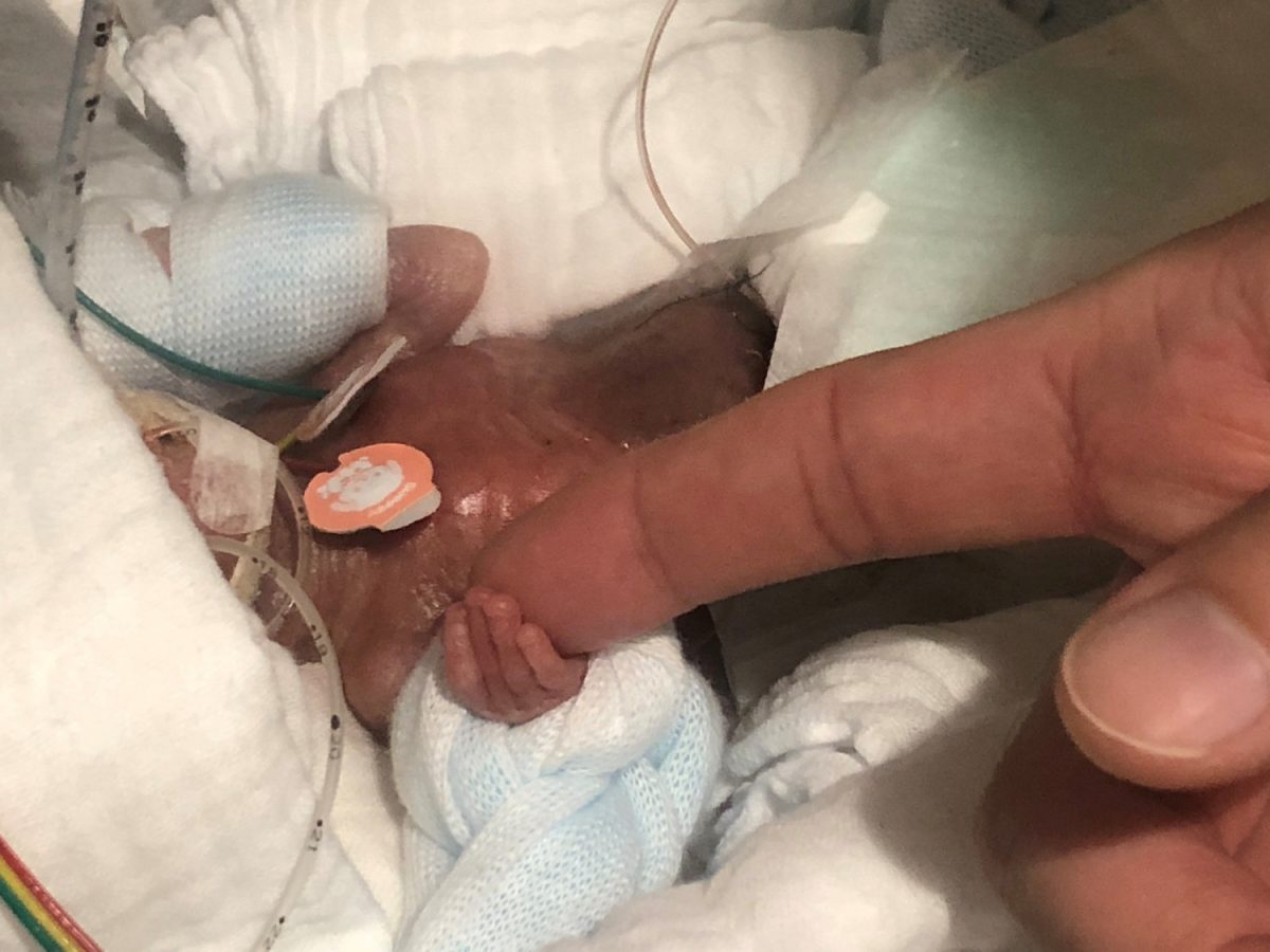 A baby boy weighing 268 grams when born in August 2018, five days after his birth in Tokyo, Japan, in this undated handout photo released on Feb. 27, 2019. (Keio University School of Medicine, Department of Pediatrics/Handout via Reuters)