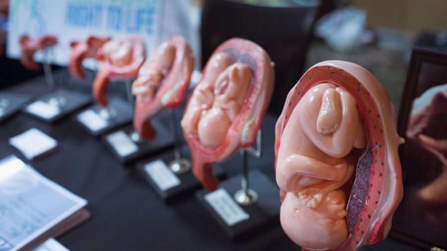 Fetal Remains Case Raises Lots of Questions, Few Answers