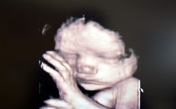 A 3D ultrasound showing a baby inside the womb. (Fotopress/Getty Images)