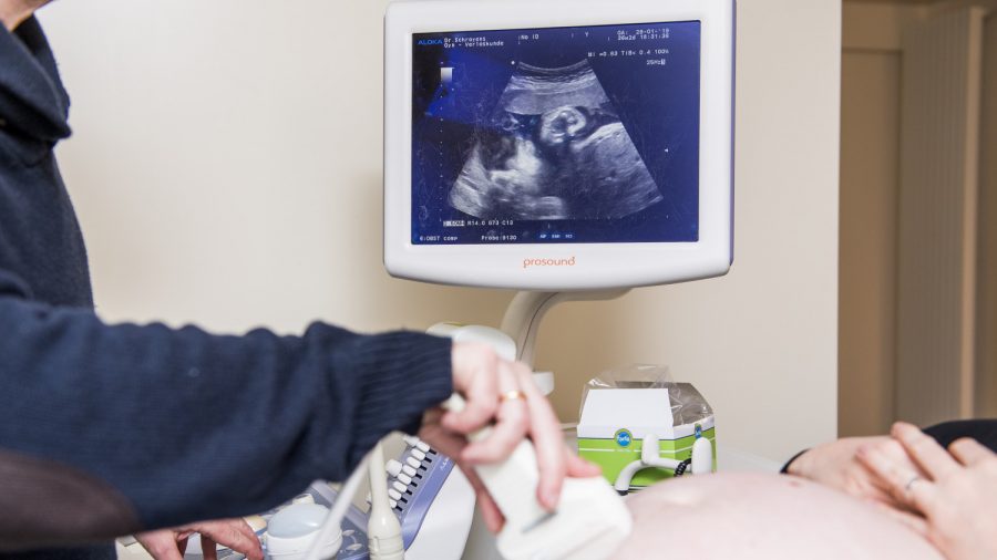 Mississippi Governor Signs Bill That Bans Abortions After Unborn Baby’s Heartbeat Detected