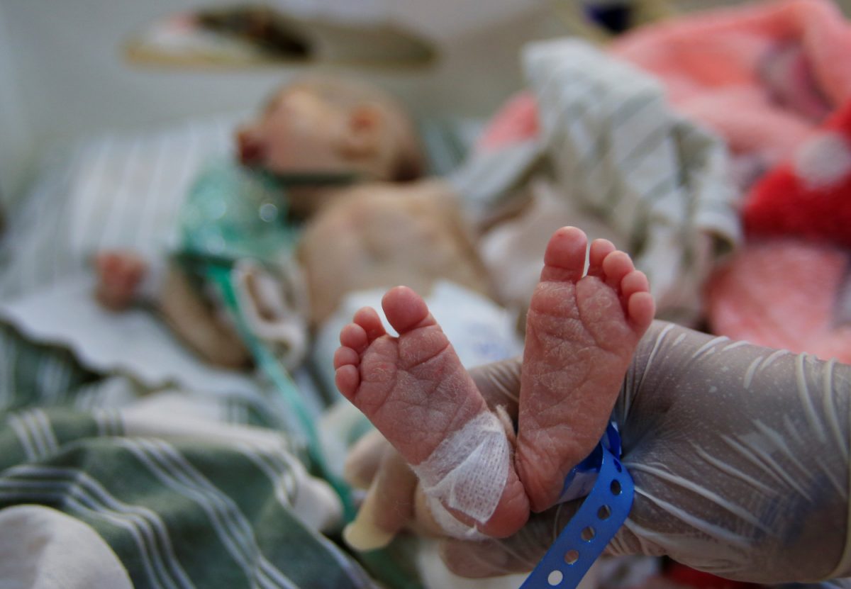 A malnourished child of dead ISIS terrorist, is seen at a hospital in Hasaka, northeastern Syria, on April 6, 2019. (Ali Hashisho/Reuters)