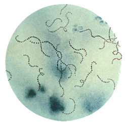 Streptococcus pyogenes on a Gram strain. (Public Health Image Library, CDC)