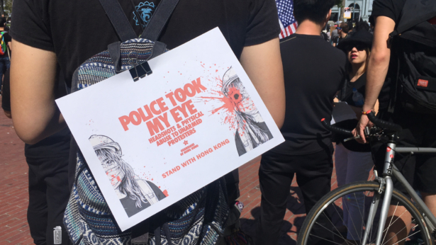 On Aug. 11, Hong Kong police shot at a protester in her right eye with a bean-bag round, rupturing her eye. Her image is used to symbolize Hong Kong police brutality in San Francisco protest on Aug. 17, 2019. (Ilene Eng/NTD)