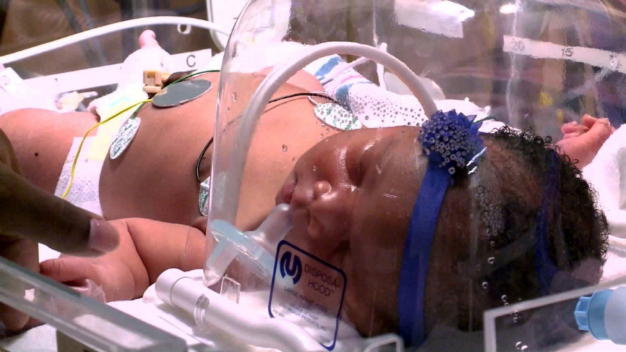 A 9-Pound, 11-Ounce Baby Born on 9/11 at 9:11 PM