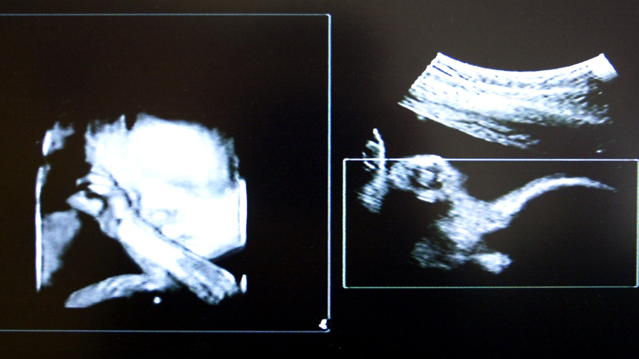 Unborn Baby Tests Positive for Meth—Parents Have No History of Drug Use