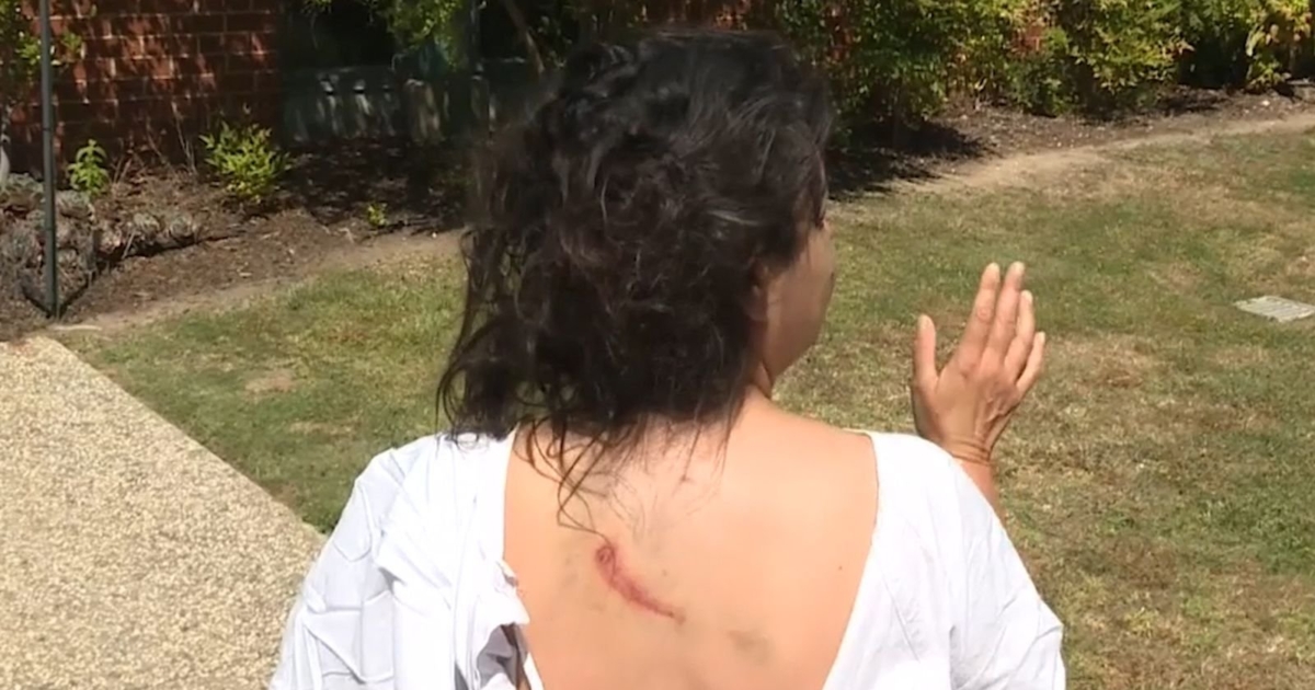 Woman Gets Mauled by Large Kangaroo While Walking Her Dog in Australia