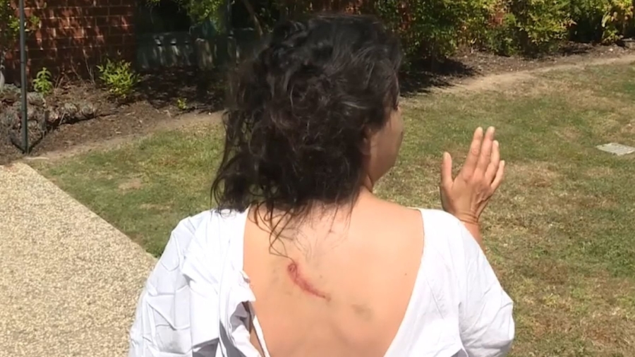 Woman Gets Mauled by Large Kangaroo While Walking Her Dog in Australia