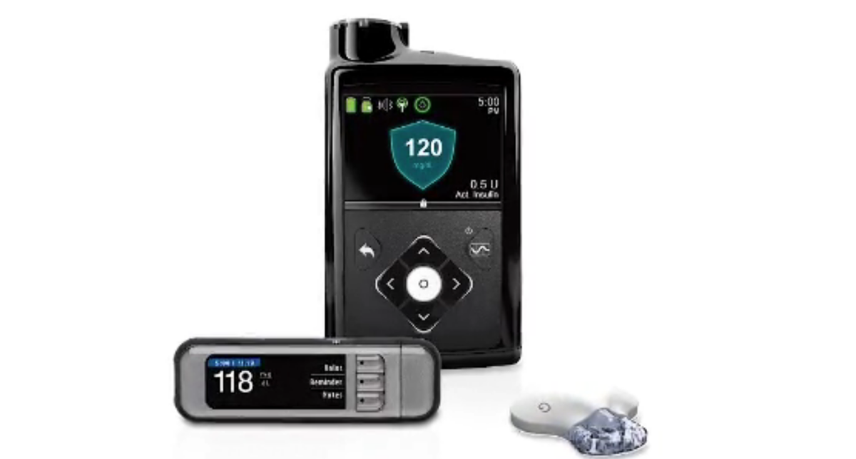 A MiniMed 670G insulin pump. (Courtesy of Medtronic)