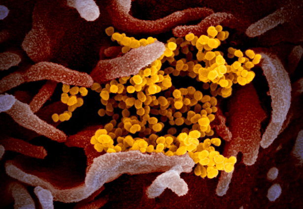 This scanning electron microscope image shows SARS-CoV-2 (yellow)—also known as 2019-nCoV, the virus that causes COVID-19 isolated from a patient in the United States, emerging from the surface of cells (pink) cultured in the lab. (NIAID-RML)