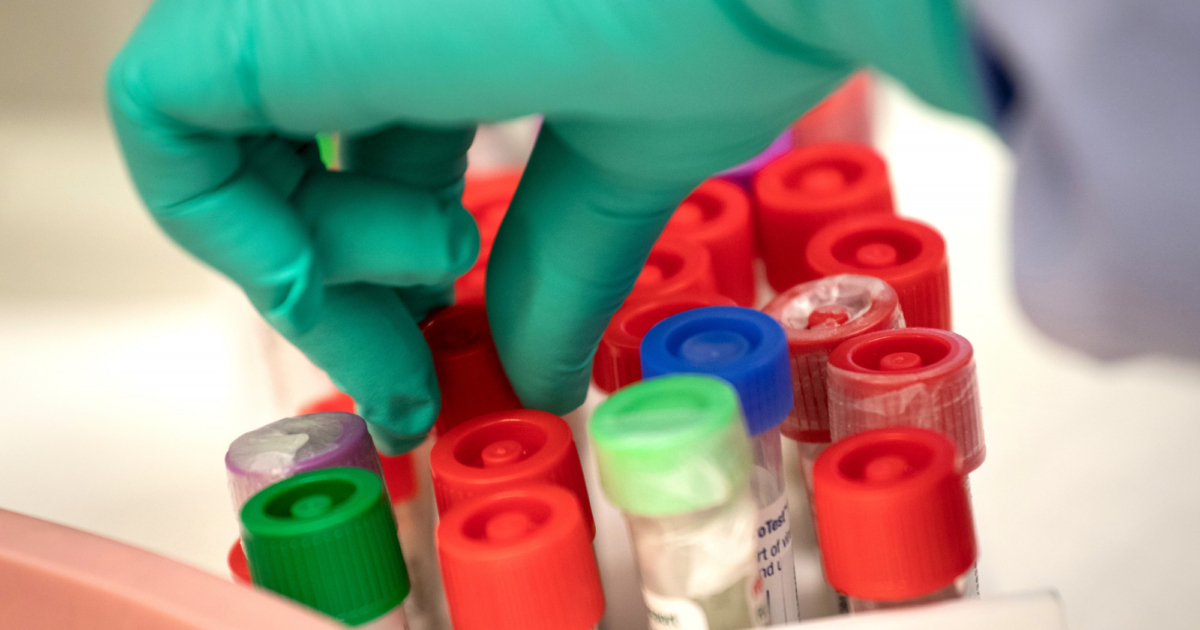 US Fertility Industry Very Unregulated and Raises Concerns of Accidental Incest: Researcher