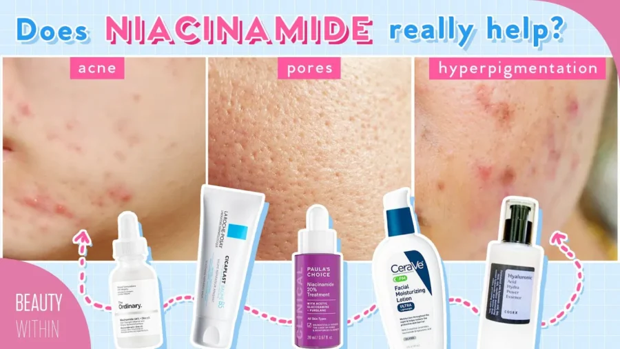 Niacinamide + Panthenol for Reducing Large Pores, Hyperpigmentation, Acne & More!