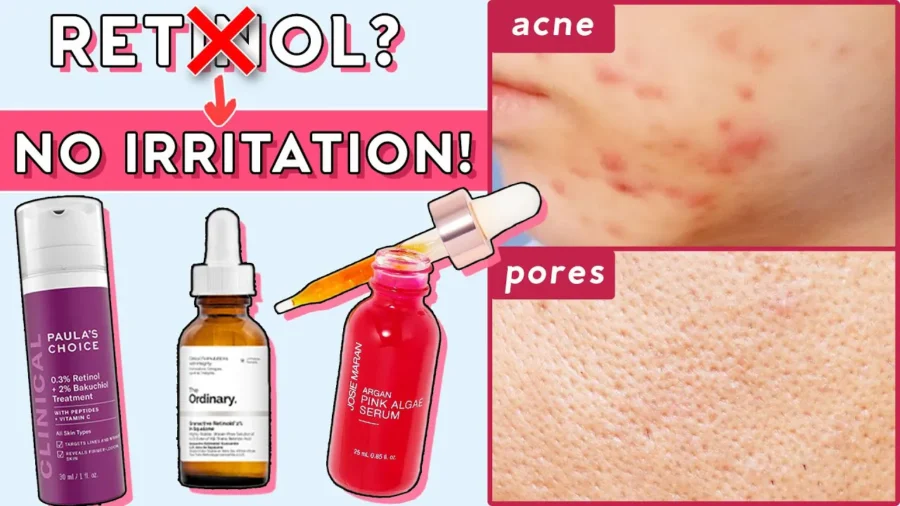 How to Use Retinol & Retinoids For Sensitive Skin and Beginners
