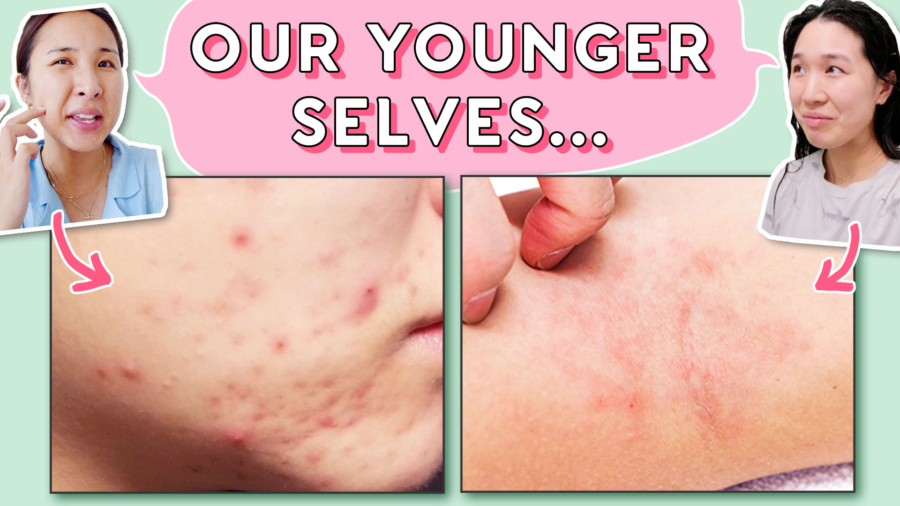 Teens & 20s: Skincare Habits We Wish Someone Told Us Earlier!