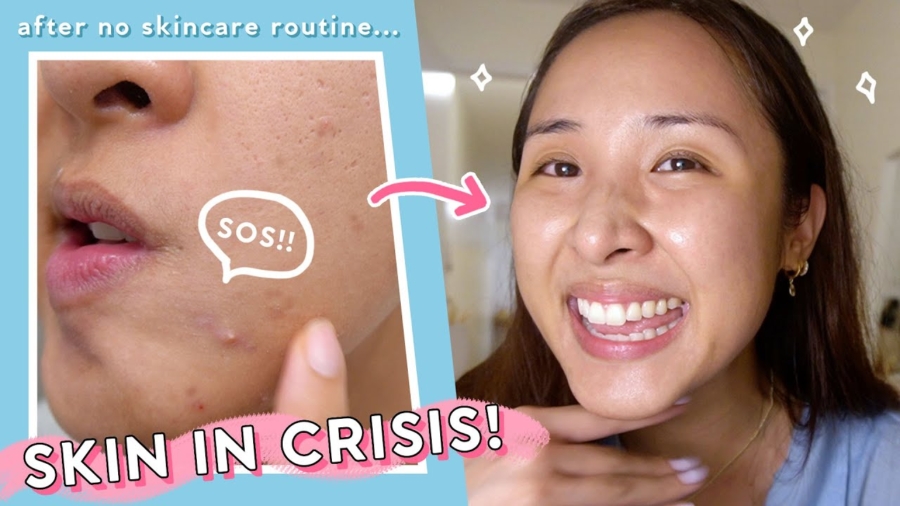 When Nothing Else Works, 3 Easy SOS Steps for All Skin Types!