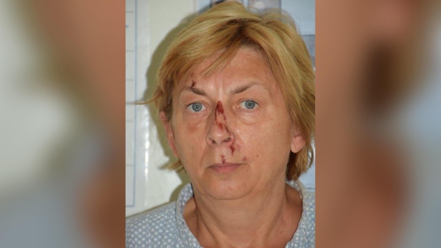 Woman Found Injured on Croatian Island Doesn’t Know Her Name or How She Got There