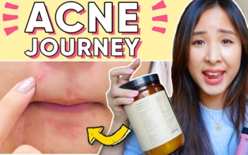 How I Used Food, Supplements, and Nutrition to Clear My Acne, Naturally
