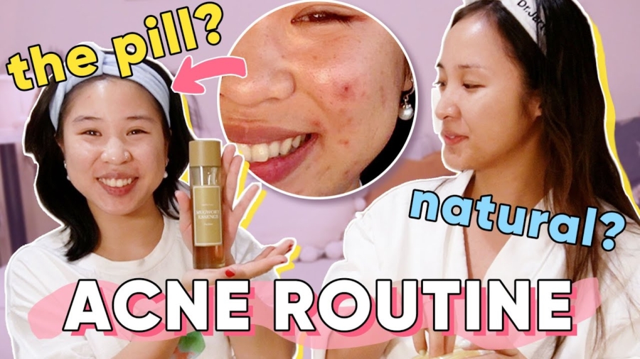 Acne-Prone Routine With My Sister | Gen Z Versus Millennial Skincare