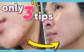 It’s Important: 3 Quick and Simple Ways to Get Rid of Pimples!