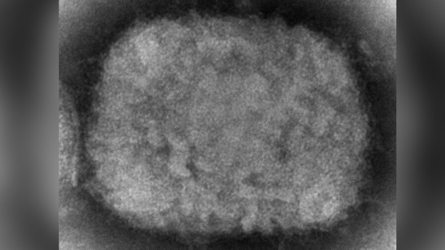 US Military Reports First Case of Monkeypox
