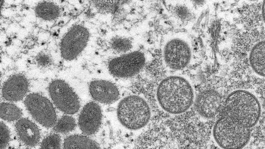 Monkeypox Detected in Growing Number of Countries