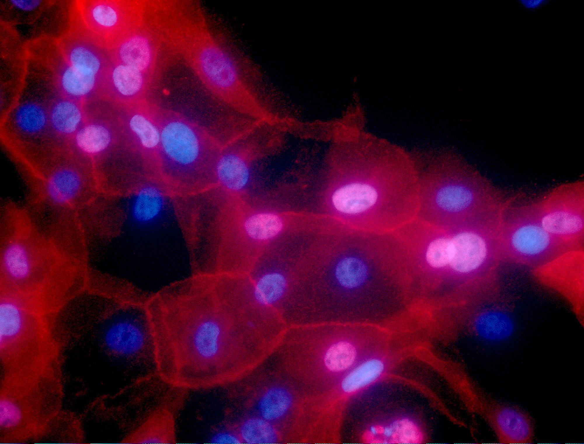 human breast cancer cells