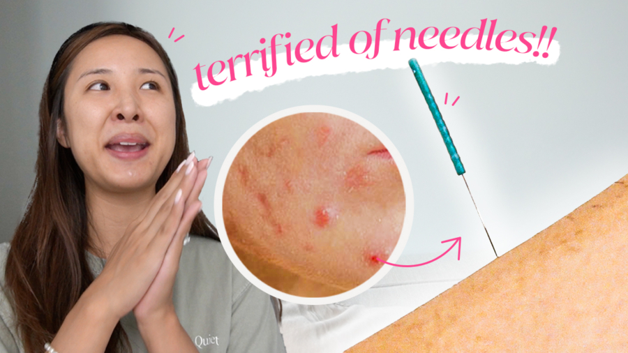 What I Tried for Acne & PMS Symptoms