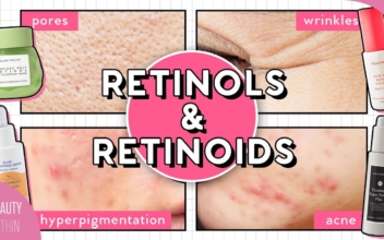 How to Use Retinol for Acne, Hyperpigmentation, Large Pores, Fine Lines, & More!