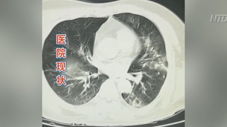 Children With 'White Lung' Symptoms Flood Chinese Hospitals; Concerns Rise Over New Wave of COVID-19