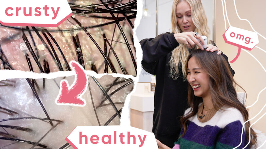 Simple Tips for Dandruff, Itchy Scalp, and Hair Loss (with celeb hair stylist)