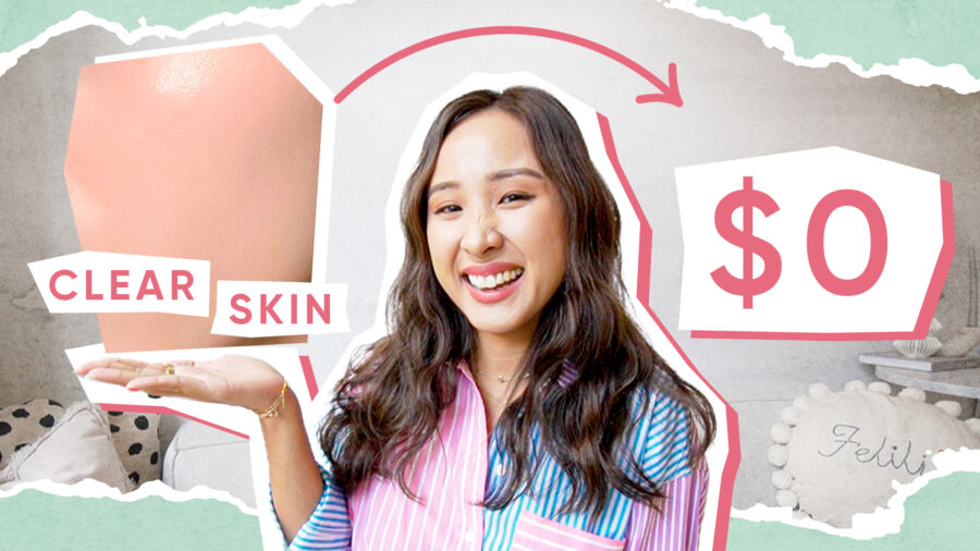 My $0 Acne Tips! They Really Work