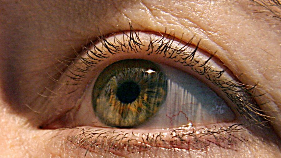 Alzheimer’s First Signs May Appear in Your Eyes, Study Finds