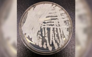 CDC Warns of Dangerous Fungal Infection Spreading Through US at ‘Alarming Rate’