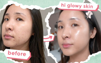 Affordable Korean Skincare Routine for Acne and Must-Try Tips