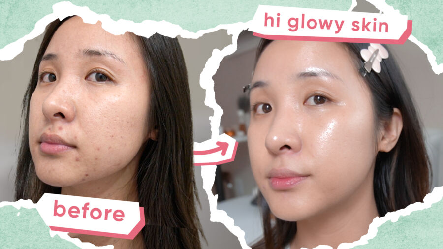 Affordable Korean Skincare Routine for Acne and Must-Try Tips