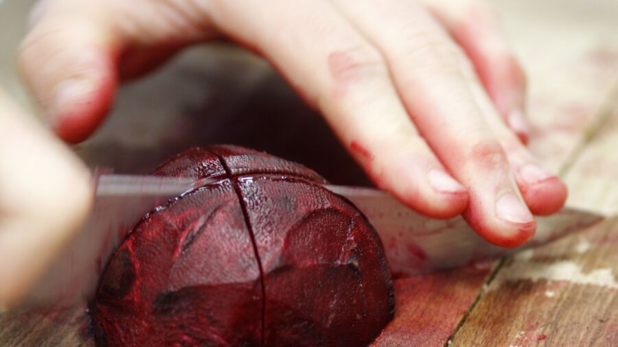 Evidence-Based Health Benefits of Beets